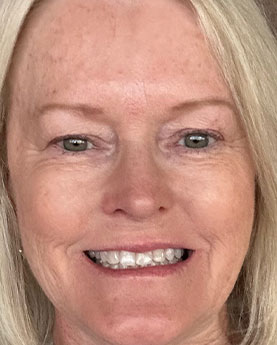 A smiling woman with light hair and freckles.