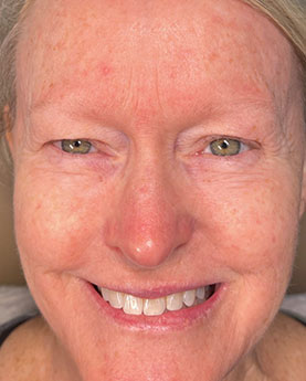 A smiling person with short hair and natural complexion, close-up.