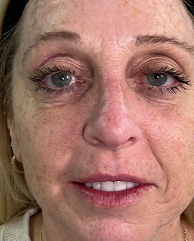 Close-up of a woman's face with wrinkles and makeup.