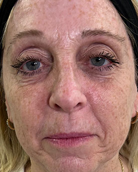 A woman with light hair and a headband, showing her face in a close-up view.