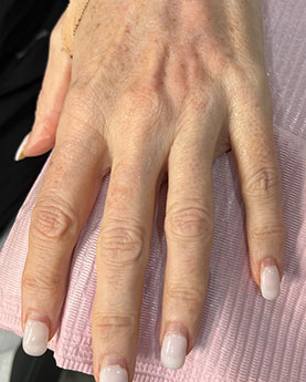 A person's hand with manicured nails rests on a pink textured surface.