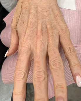 Close-up of a person's hand resting on a pink striped fabric surface.